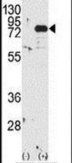 PKC beta Antibody in Western Blot (WB)