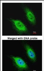 PKC epsilon Antibody in Immunocytochemistry (ICC/IF)