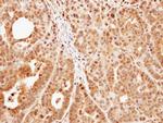 PKC epsilon Antibody in Immunohistochemistry (IHC)