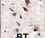 PKC gamma Antibody in Immunohistochemistry (IHC)