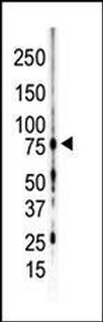 PKC gamma Antibody in Western Blot (WB)