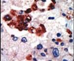 PKC lambda/iota Antibody in Immunohistochemistry (IHC)