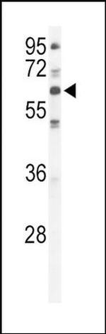PKC lambda/iota Antibody in Western Blot (WB)