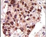 PRKD3 Antibody in Immunohistochemistry (IHC)