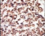 PRKD3 Antibody in Immunohistochemistry (IHC)