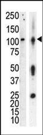 PRKD3 Antibody in Western Blot (WB)