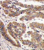 PKC zeta Antibody in Immunohistochemistry (IHC)