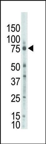 PKC zeta Antibody in Western Blot (WB)