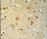PLEKHH2 Antibody in Immunohistochemistry (IHC)