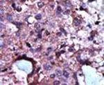 PKLR Antibody in Immunohistochemistry (IHC)