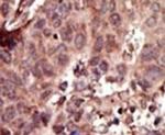 PKLR Antibody in Immunohistochemistry (IHC)