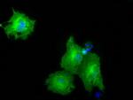PKLR Antibody in Immunocytochemistry (ICC/IF)