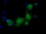 PKLR Antibody in Immunocytochemistry (ICC/IF)
