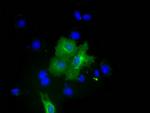 PKLR Antibody in Immunocytochemistry (ICC/IF)