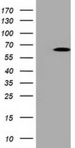 PKLR Antibody in Western Blot (WB)