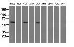 PKLR Antibody in Western Blot (WB)