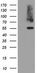 PKLR Antibody in Western Blot (WB)