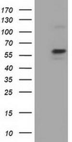 PKLR Antibody in Western Blot (WB)