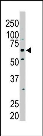 PKLR Antibody in Western Blot (WB)
