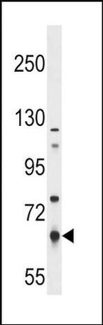 PKLR Antibody in Western Blot (WB)