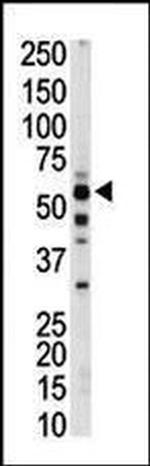 PKLR Antibody in Western Blot (WB)