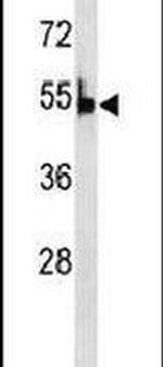 PKLR Antibody in Western Blot (WB)