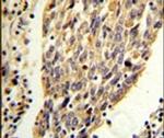 PKM2 Antibody in Immunohistochemistry (IHC)