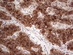 PKM2 Antibody in Immunohistochemistry (Paraffin) (IHC (P))