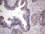 PKM2 Antibody in Immunohistochemistry (Paraffin) (IHC (P))