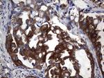 PKM2 Antibody in Immunohistochemistry (Paraffin) (IHC (P))