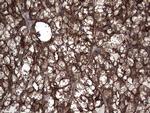 PKM2 Antibody in Immunohistochemistry (Paraffin) (IHC (P))