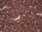 PKM2 Antibody in Immunohistochemistry (Paraffin) (IHC (P))