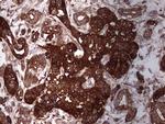 PKM2 Antibody in Immunohistochemistry (Paraffin) (IHC (P))