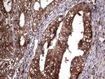 PKM2 Antibody in Immunohistochemistry (Paraffin) (IHC (P))