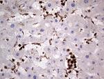 PKM2 Antibody in Immunohistochemistry (Paraffin) (IHC (P))