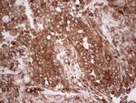 PKM2 Antibody in Immunohistochemistry (Paraffin) (IHC (P))