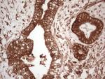 PKM2 Antibody in Immunohistochemistry (Paraffin) (IHC (P))