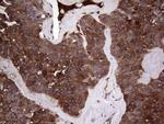 PKM2 Antibody in Immunohistochemistry (Paraffin) (IHC (P))