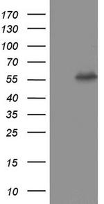 PKM2 Antibody in Western Blot (WB)