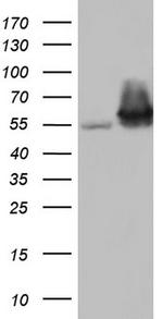 PKM2 Antibody in Western Blot (WB)
