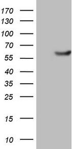 PKM2 Antibody in Western Blot (WB)