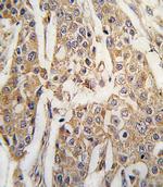 PKM2 Antibody in Immunohistochemistry (IHC)