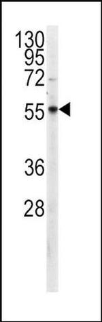 PKM2 Antibody in Western Blot (WB)