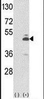 PKM2 Antibody in Western Blot (WB)