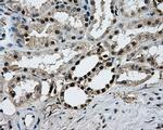 PKMYT1 Antibody in Immunohistochemistry (Paraffin) (IHC (P))