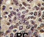 PKN3 Antibody in Immunohistochemistry (IHC)