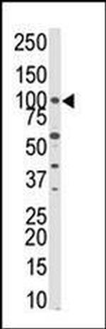 PKN3 Antibody in Western Blot (WB)