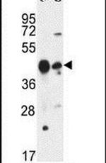 PLA1A Antibody in Western Blot (WB)