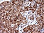 PLA2G16 Antibody in Immunohistochemistry (Paraffin) (IHC (P))