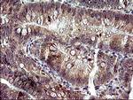 PLA2G16 Antibody in Immunohistochemistry (Paraffin) (IHC (P))
